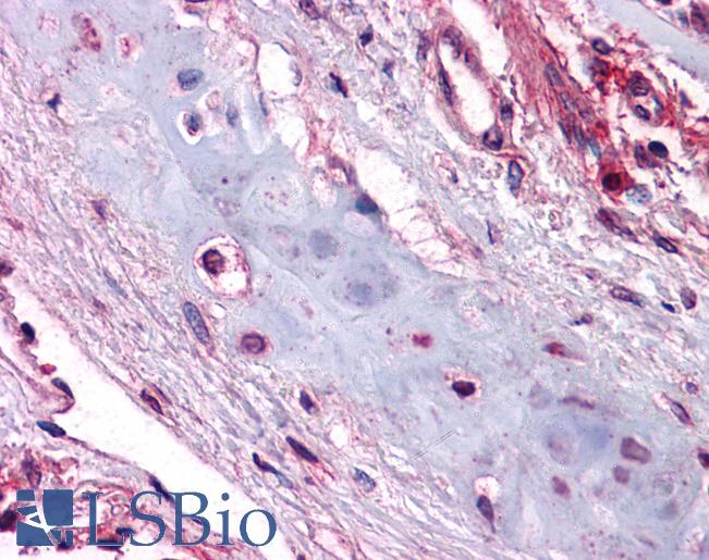 Anti-UCMA antibody IHC of human lung, chondrocytes. Immunohistochemistry of formalin-fixed, paraffin-embedded tissue after heat-induced antigen retrieval. Antibody LS-B5005 concentration 5 ug/ml.