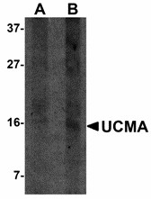 Western blot of UCMA in SW1353 cell lysate with UCMA antibody at (A) 2.5 and (B) 5 ug/ml.