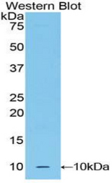 Western blot of recombinant UCN2 / SRP.