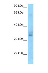 UCP1 antibody LS-C146311 Western blot of Jurkat Cell lysate. Antibody concentration 1 ug/ml.