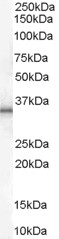 Antibody (1 ug/ml) staining of Human Adipose lysate (35 ug protein in RIPA buffer). Primary incubation was 1 hour. Detected by chemiluminescence.
