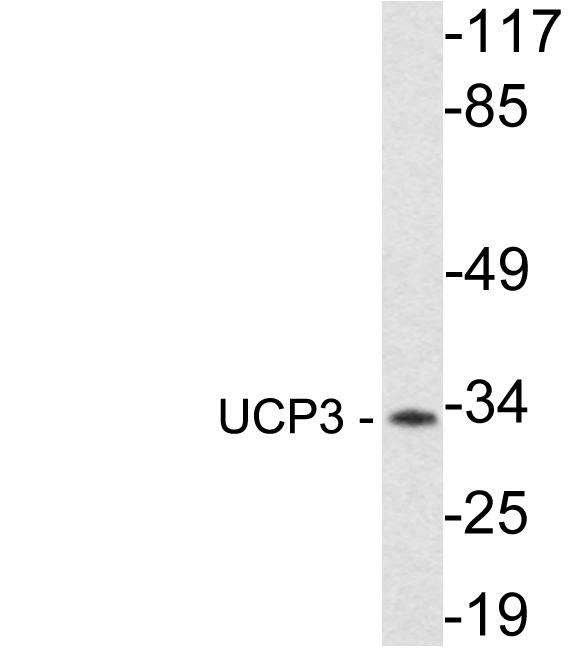 Western blot of UCP3 (R308) pAb in extracts from Jurkat cells.