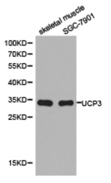 Western blot of extracts of skeletal muscle cell and SGC-7901 cell line, using UCP3 antibody.