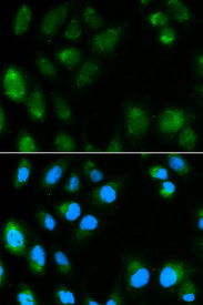Immunofluorescence analysis of MCF7 cell using UCP3 antibody. Blue: DAPI for nuclear staining.