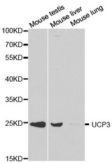 Western blot analysis of extracts of various cell lines, using UCP3 antibody.