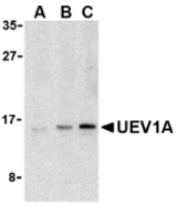 Western blot of UEV1A in Jurkat cell lysates with UEV1A antibody at (A) 1, (B) 2, and (C) 4 ug/ml.
