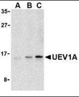 Western blot of UEV1A in Jurkat cell lysates with UEV1A antibody at (A) 1, (B) 2, and (C) 4 g/ml