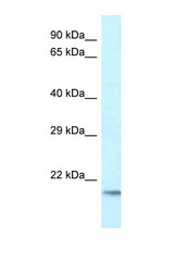 UBE2V1 antibody LS-C145663 Western blot of Fetal Brain lysate. Antibody concentration 1 ug/ml.