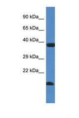 UBE2V1 antibody LS-C145417 Western blot of Fetal Liver lysate. Antibody concentration 1 ug/ml.