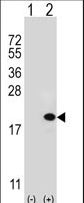 Western blot of UBE2V1 (arrow) using rabbit polyclonal UBE2V1 Antibody (M151). 293 cell lysates (2 ug/lane) either nontransfected (Lane 1) or transiently transfected (Lane 2) with the UBE2V1 gene.