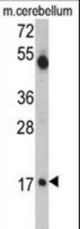 Western blot of UBE2V1 Antibody in mouse cerebellum tissue lysates (35 ug/lane). UBE2V1 (arrow) was detected using the purified antibody.