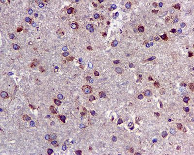 IHC of paraffin-embedded human brain tissue using anti-UGGT1 antibody.