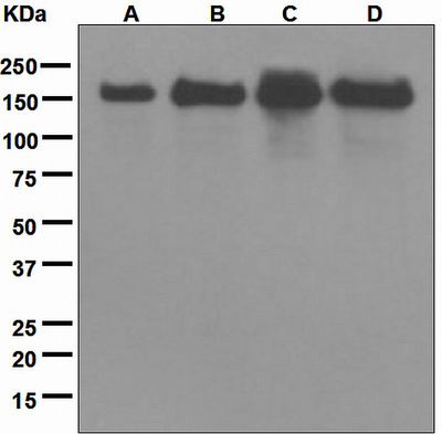Western blot analysis on (A) human skeletal muscle, (B) BXPC-3, (C) SH-SY5Y, and (D) MCF-7 lysates using anti-UGGT1 antibody.