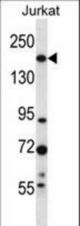 UGCGL1 Antibody western blot of Jurkat cell line lysates (35 ug/lane). The UGCGL1 antibody detected the UGCGL1 protein (arrow).