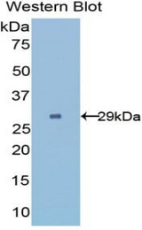 Western blot of recombinant UGGT2.