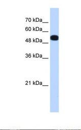 HepG2 cell lysate. Antibody concentration: 0.25 ug/ml. Gel concentration: 12%.