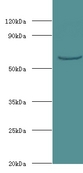 Western blot of UTP--glucose-1-phosphate uridylyltransferase antibody at 2 ug/ml with mouse liver tissue secondary Goat polyclonal to rabbit at 1:10000 dilution predicted band size: 57 KDa observed band size: 57 KDa.