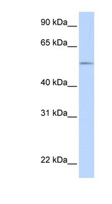 UGT1A1 antibody LS-C102087 Western blot of Fetal Muscle lysate.