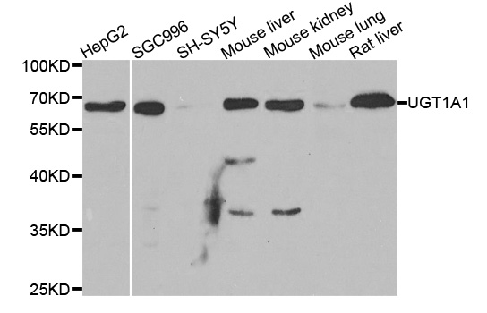 Western blot analysis of extracts of various cell lines, using UGT1A1 antibody.