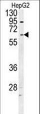 UGT1A1 Antibody western blot of HepG2 cell line lysates (35 ug/lane). The UGT1A1 antibody detected the UGT1A1 protein (arrow).