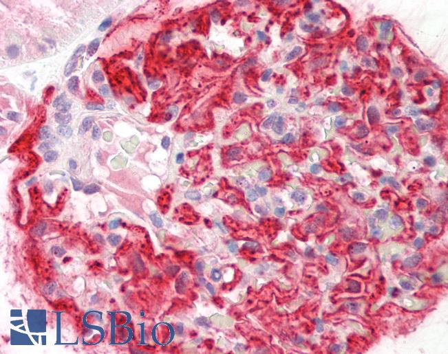 Human Kidney: Formalin-Fixed, Paraffin-Embedded (FFPE)