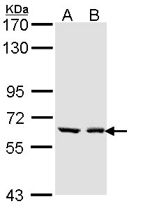 Sample (30 ug of whole cell lysate). A: A431. B: H1299. 7.5% SDS PAGE. UGT1A6 antibody diluted at 1:1000.
