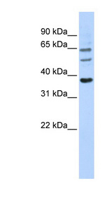 UGT1A9 antibody LS-C110702 Western blot of 293T cell lysate.
