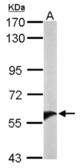 Sample (50 ug of whole cell lysate). A: mouse liver. 7.5% SDS PAGE. UGT1A9 antibody diluted at 1:10000.