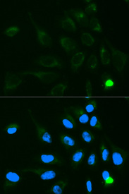Immunofluorescence analysis of MCF7 cell using UGT1A9 antibody. Blue: DAPI for nuclear staining.