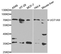 Western blot analysis of extracts of various cell lines, using UGT1A9 antibody.