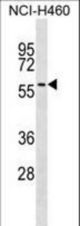 UGT2A3 Antibody western blot of NCI-H460 cell line lysates (35 ug/lane). The UGT2A3 antibody detected the UGT2A3 protein (arrow).