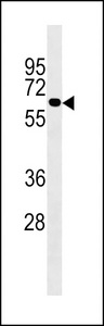 UGT2B10 Antibody western blot of 293 cell line lysates (35 ug/lane). The UGT2B10 antibody detected the UGT2B10 protein (arrow).
