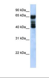 Fetal lung lysate. Antibody concentration: 1.0 ug/ml. Gel concentration: 12%.