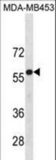 UGT2B4 Antibody western blot of MDA-MB453 cell line lysates (35 ug/lane). The UGT2B4 antibody detected the UGT2B4 protein (arrow).