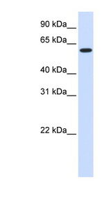 UGT8 antibody LS-C102172 Western blot of Fetal Heart lysate.