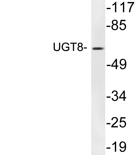 Western blot of extracts from human heart , using UGT8 antibody.