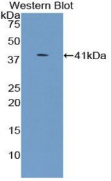 Western blot of recombinant UGT8.
