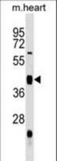 Mouse Uhmk1 Antibody western blot of mouse heart tissue lysates (35 ug/lane). The Uhmk1 antibody detected the Uhmk1 protein (arrow).