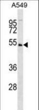 KIS Antibody (C6) western blot of A549 cell line lysates (35 ug/lane). The KIS antibody detected the KIS protein (arrow).