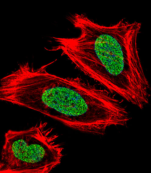 Fluorescent confocal image of HeLa cell stained with UHRF1 Antibody. HeLa cells were fixed with 4% PFA (20 min), permeabilized with Triton X-100 (0.1%, 10 min), then incubated with UHRF1 primary antibody (1:25, 1 h at 37°C). For secondary antibody, Alexa Fluor 488 conjugated donkey anti-rabbit antibody (green) was used (1:400, 50 min at 37°C). Cytoplasmic actin was counterstained with Alexa Fluor 555 (red) conjugated Phalloidin (7units/ml, 1 h at 37°C). Nuclei were counterstained with DAPI (blue) (10 ug/ml, 10 min). UHRF1 immunoreactivity is localized to Nucleus significantly.