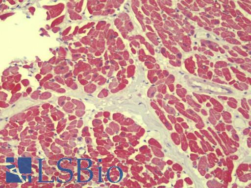 Anti-UHRF1BP1 / ICBP90 antibody IHC staining of human heart. Immunohistochemistry of formalin-fixed, paraffin-embedded tissue after heat-induced antigen retrieval. Antibody LS-B9561 concentration 5 ug/ml.