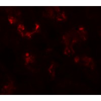 Immunofluorescence of UHRF1BP1 in human kidney tissue with UHRF1BP1 antibody at 20 µg/mL.
