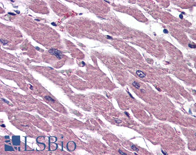 Anti-UIMC1 / RAP80 antibody IHC of human heart. Immunohistochemistry of formalin-fixed, paraffin-embedded tissue after heat-induced antigen retrieval. Antibody LS-B2707 concentration 5 ug/ml.