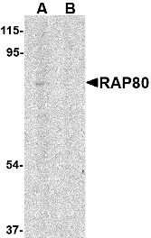 Immunohistochemistry of RAP80 in human spleen tissue with RAP80 antibody at 2.5 µg/ml.