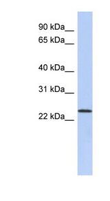 ULBP1 antibody LS-C111247 Western blot of PANC1 cell lysate.
