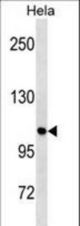 ULK1 Antibody (S317) western blot of HeLa cell line lysates (35 ug/lane). The ULK1 antibody detected the ULK1 protein (arrow).
