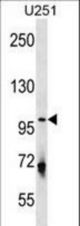 ULK1 Antibody (Center S556)western blot of U251 cell line lysates (35 ug/lane). The ULK1 antibody detected the ULK1 protein (arrow).