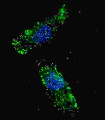 Fluorescent image of U251 cells stained with APG1 (ULK1) antibody. U251 cells were treated with Chloroquine (50 mu M,16h), then fixed with 4% PFA (20 min), permeabilized with Triton X-100 (0.2%, 30 min). Cells were then incubated APG1 (ULK1) primary antibody (1:100, 2 h at room temperature). For secondary antibody, Alexa Fluor 488 conjugated donkey anti-rabbit antibody (green) was used (1:1000, 1h). Nuclei were counterstained with Hoechst 33342 (blue) (10 ug/ml, 5 min). APG1 (ULK1) immunoreactivity is localized to autophagic vacuoles in the cytoplasm of U251 cells.