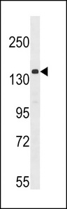 Western blot of anti-ULK1 antibody in A2058 cell lysate. ULK1 (arrow) was detected using purified antibody. Secondary HRP-anti-rabbit was used for signal visualization with chemiluminescence.