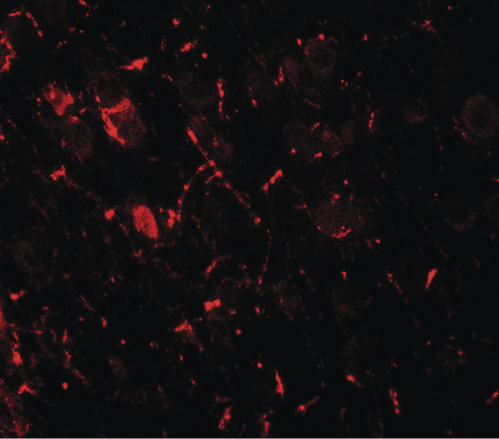 Immunofluorescence of ULK1 in rat brain tissue with ULK1 antibody at 20 ug/ml.